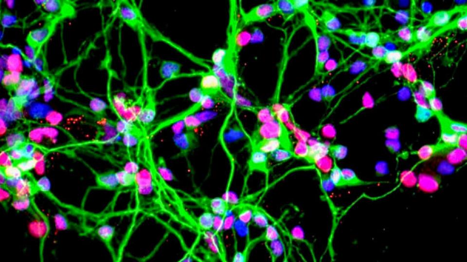 <p>Neurons growing in a culture dish (NASA)</p> Neurons growing in a culture dish (NASA)